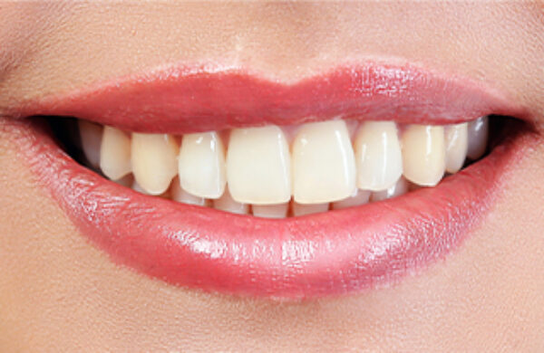 Before - Q Dental